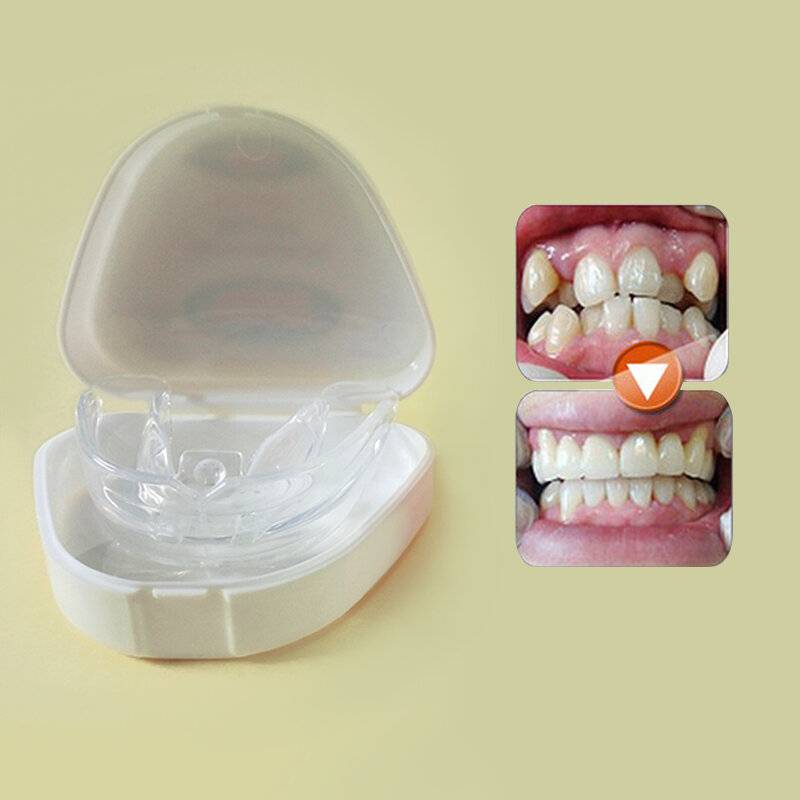 Пластины для выравнивания зубов у детей (10 фото): цены, сколько стоит поставить, отзывы