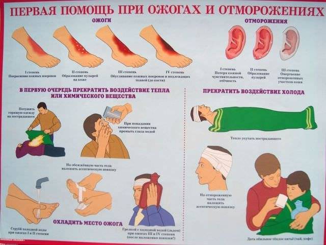Ожог у ребенка: что делать и как помочь
