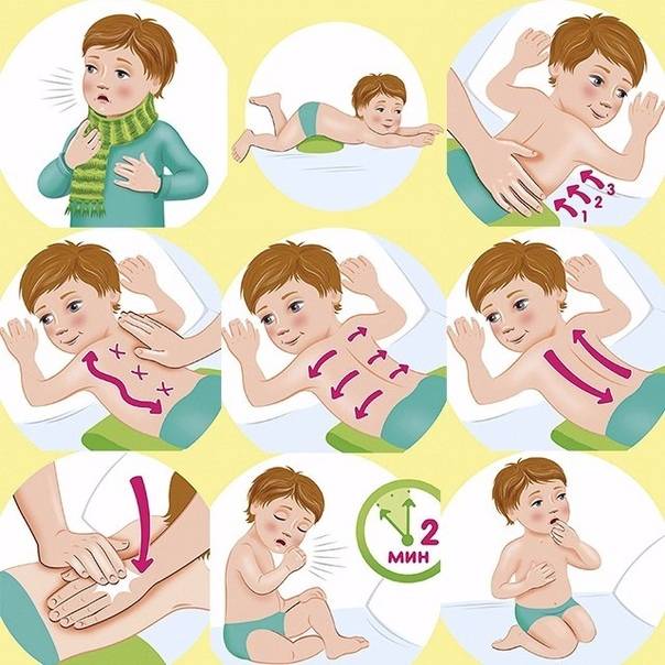 Как делать дренажный массаж для отхождения мокроты при кашле у грудного ребенка