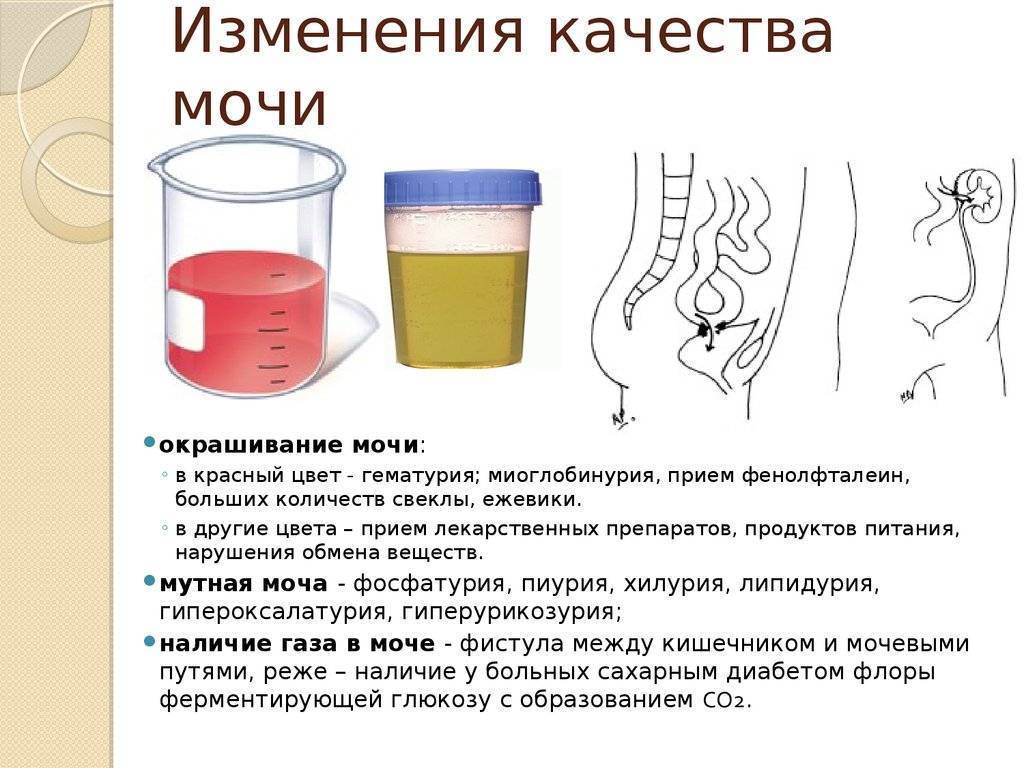 Кровь в моче у детей: причины крови в моче у детей, прием уролога в москве