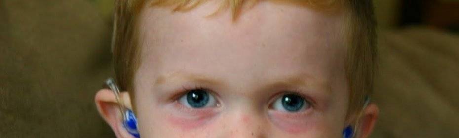 Почему у ребенка появляются синяки под глазами: причины и способы лечения
