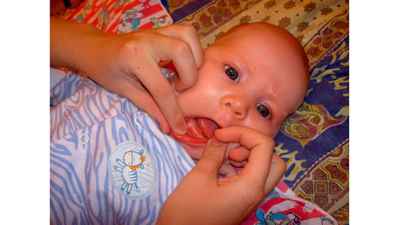Отек глаз у ребенка после сна: причины, методы лечения и профилактика