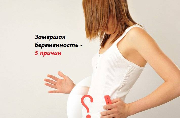 Почему замирает беременность?