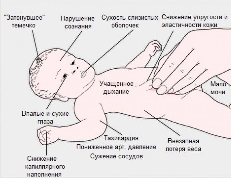 Лечение стоматита у детей: симптомы, виды и профилактика