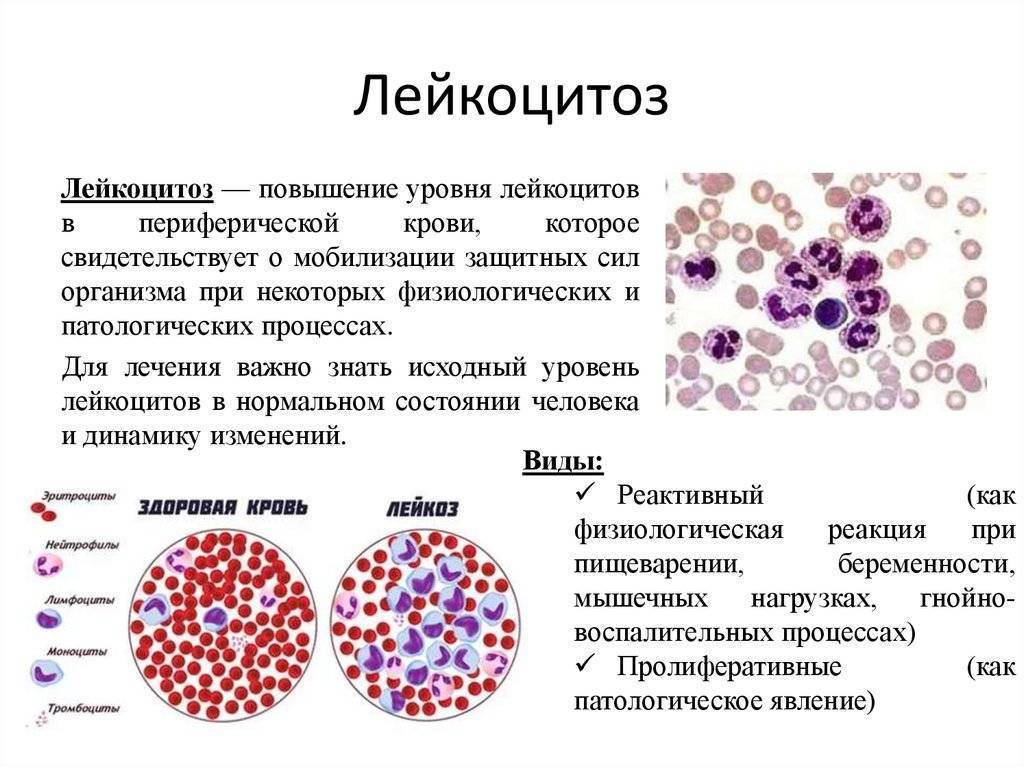 Ревматологическое обследование. анализ крови на уровень мочевой кислоты, ревматоидный фактор и пр.