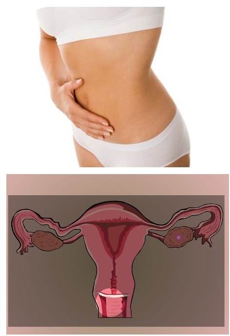 Перед месячными болит яичник (правый или левый) - беременность или нет