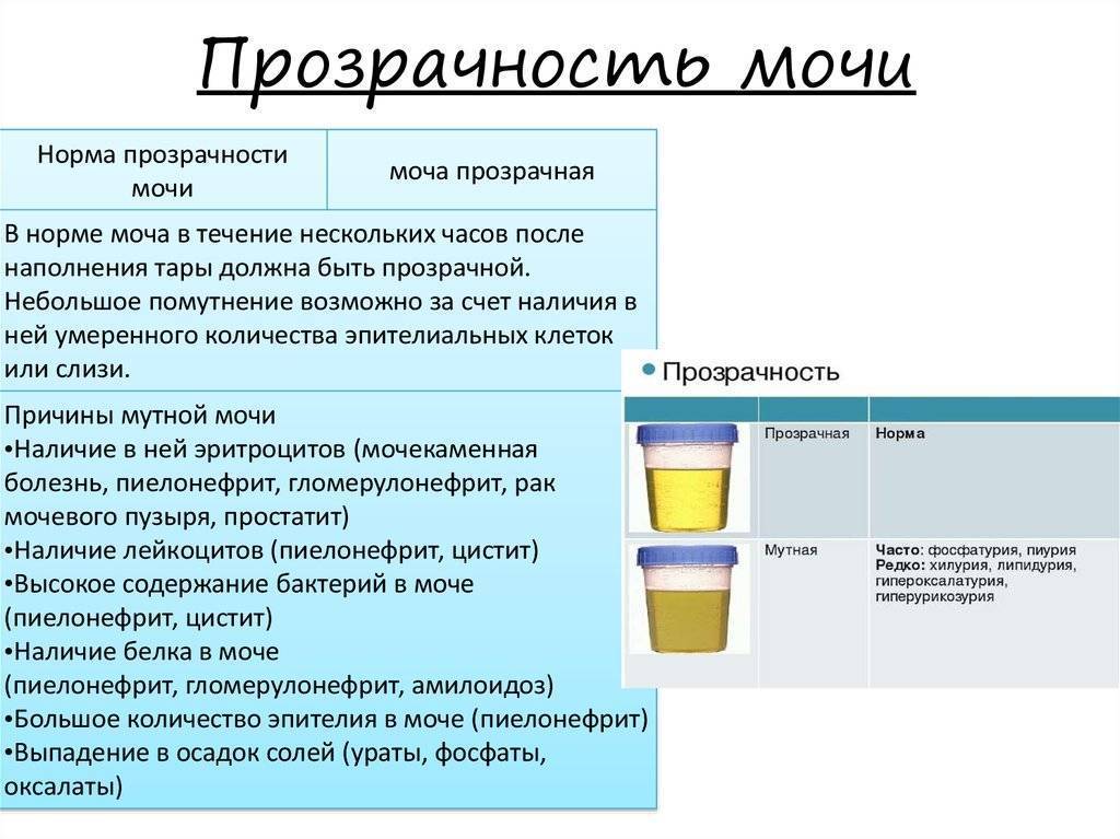 Белок в моче