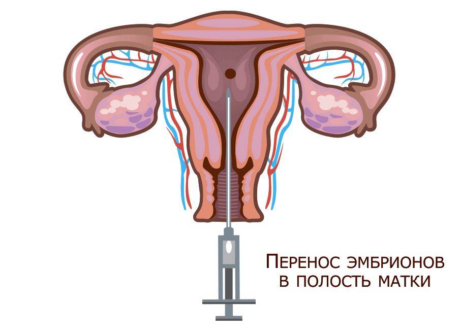 Беременность после эко|что происходит в организме после переноса эмбрионов