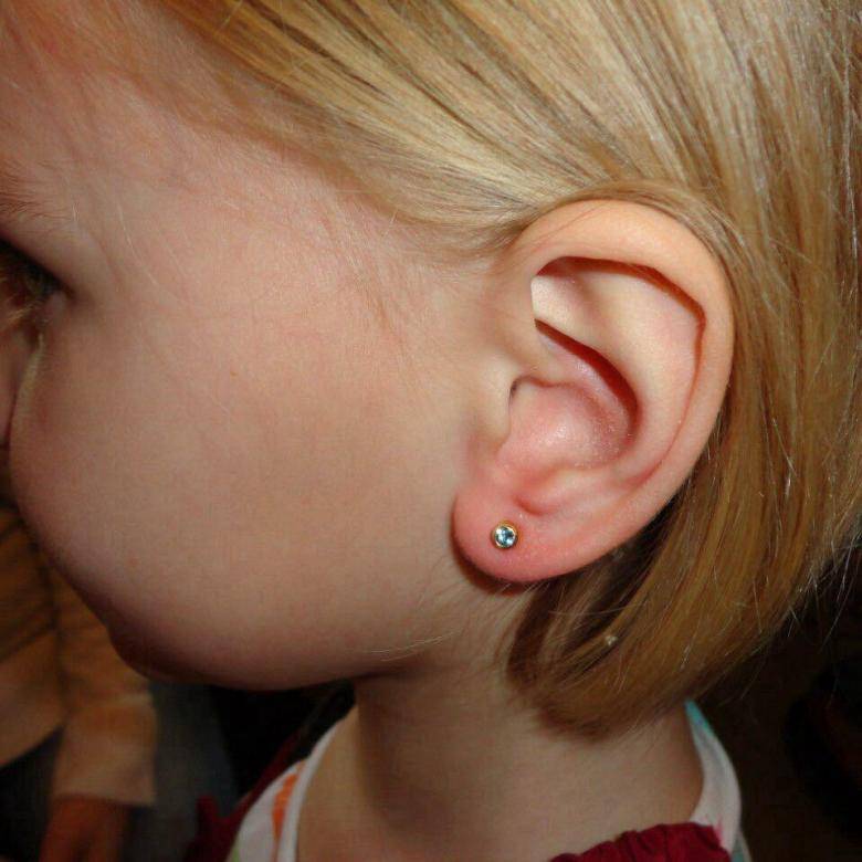 Проколоть уши детям: оптимальный возраст и методика прокола