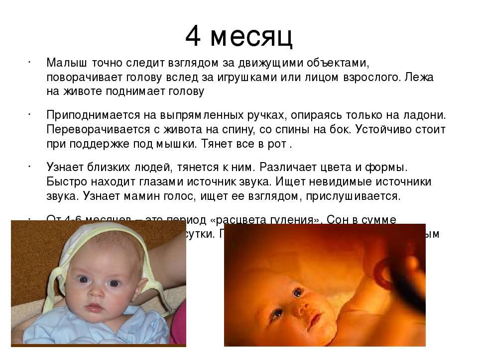 Деформация головы у новорожденного - что нужно знать родителям - beautyvertebro.com