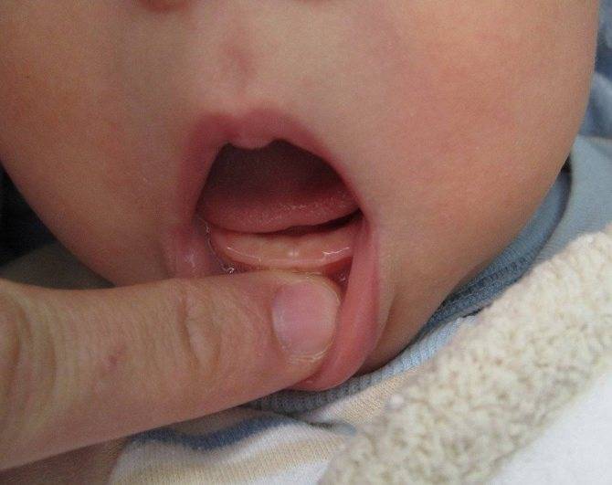 Во сколько первый зуб у ребенка. во сколько режутся зубы у грудничков: сроки, симптомы, помощь