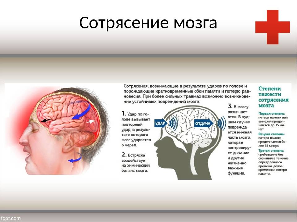 Как вовремя распознать у ребенка черепно-мозговую травму: объясняет врач - новости yellmed.ru