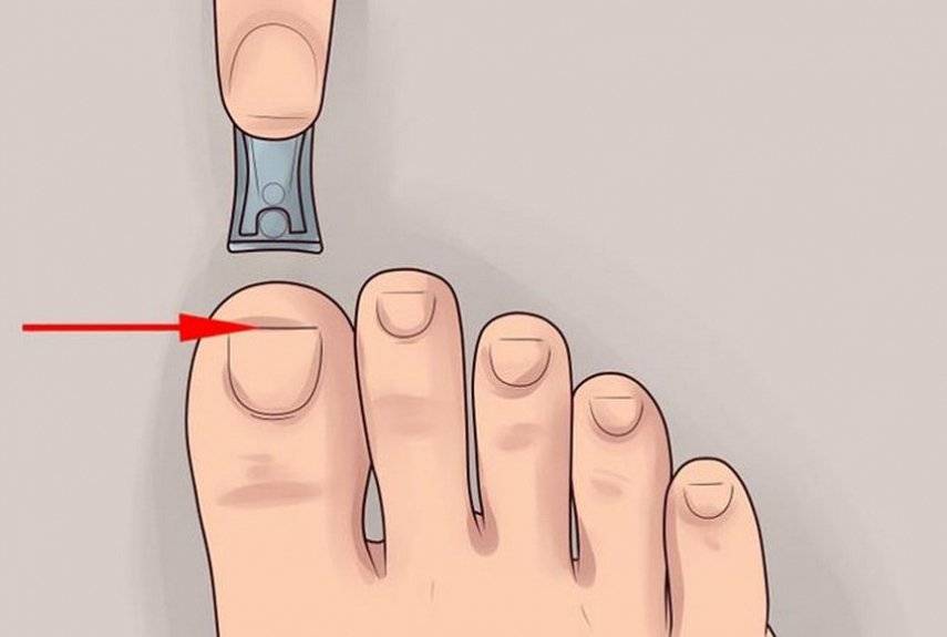 Как правильно стричь ногти на ногах: подготовка, пошаговая инструкция