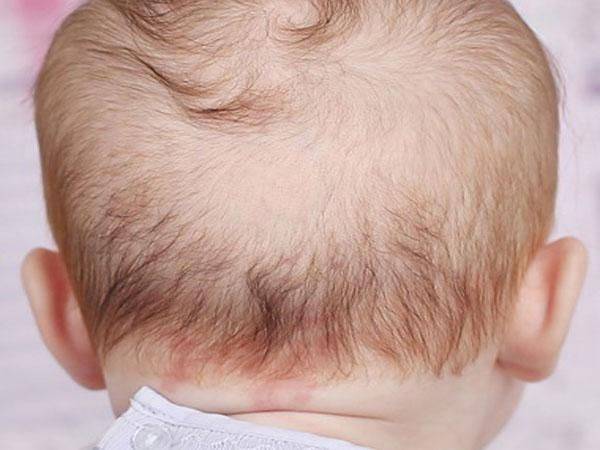 Ломкость волос : причины и лечение ломкости волос | компетентно о здоровье на ilive