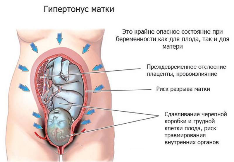 Боли во втором триместре у беременных | что делать, если болит тело во втором триместре? | лечение боли и симптомы болезни на eurolab