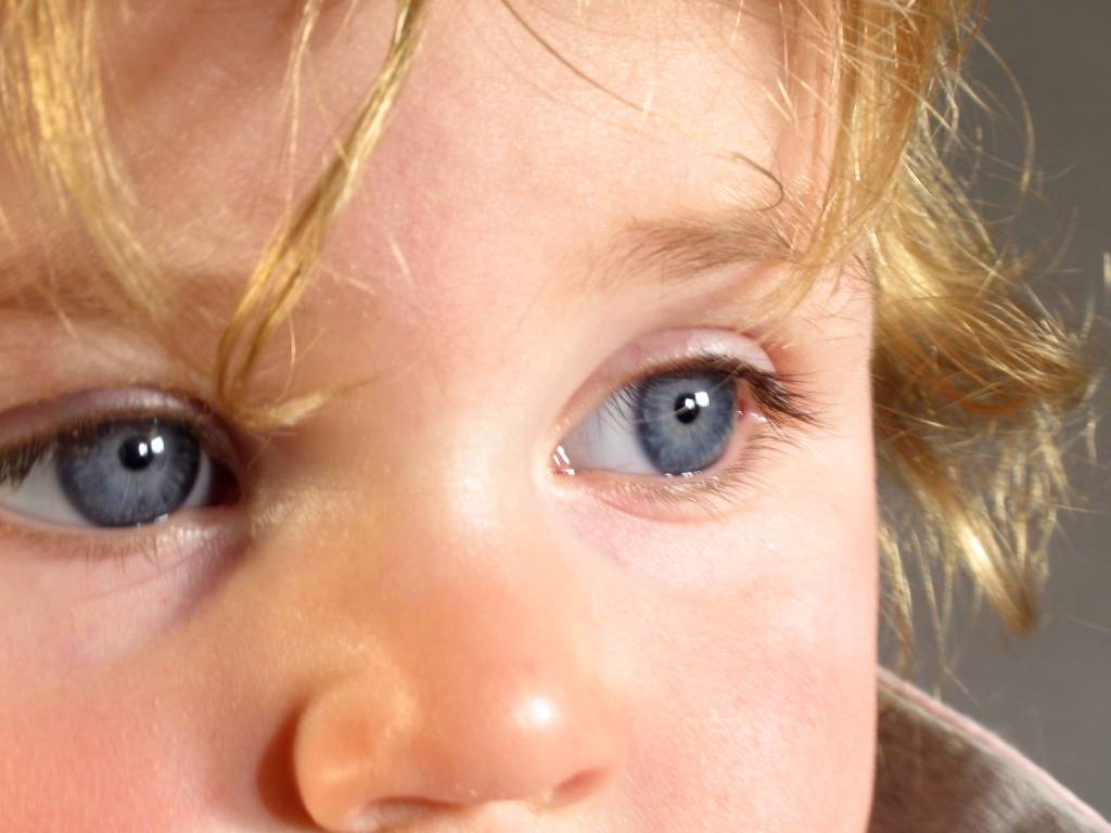 Ангиопатия сетчатки глаза у ребенка - что это, лечение, причины, симптомы