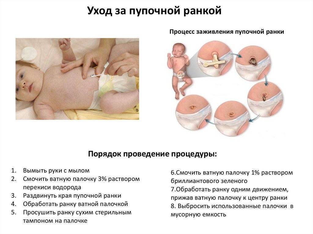Хлорофиллипт для новорожденных: для обработки пупка, от потницы