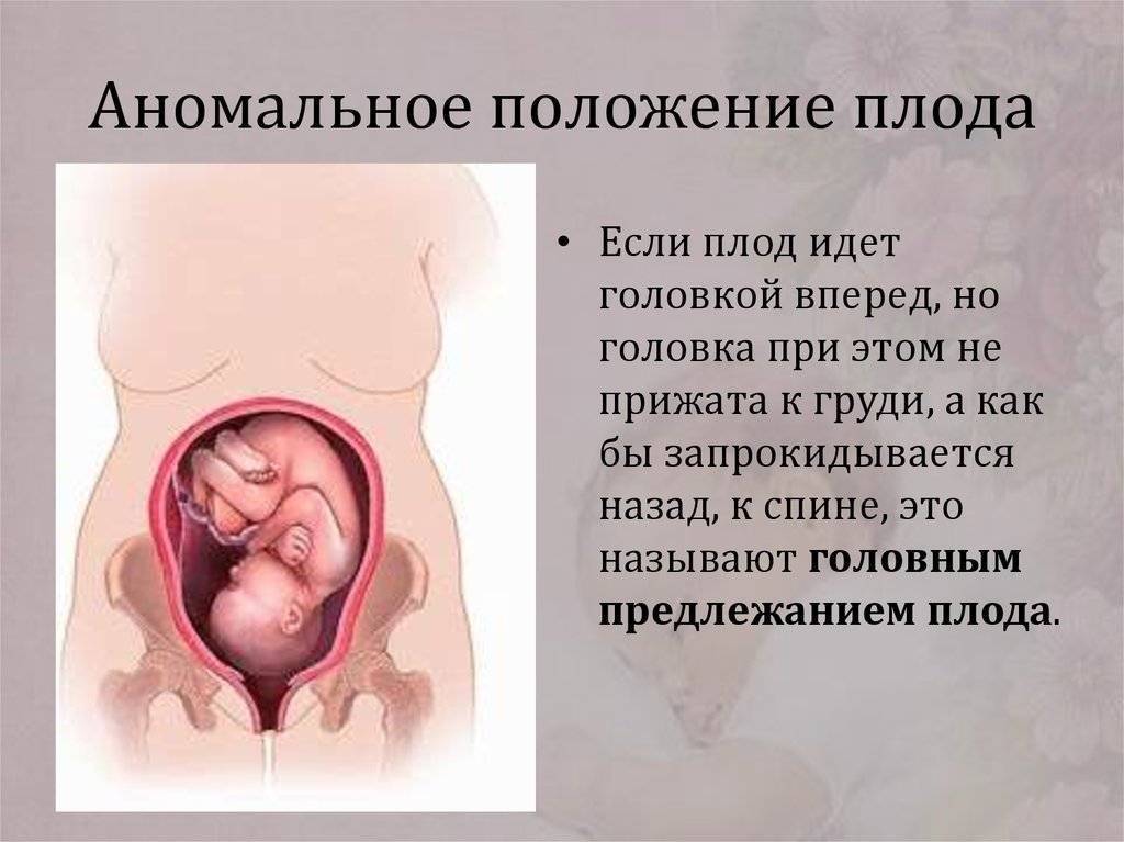 Как определить по шевелениям: как лежит ребенок в утробе матери