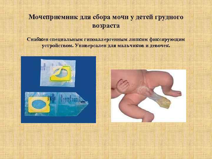 Как правильно собрать мочу у новорожденного или грудничка, мальчика или девочки, используя мочеприемник?