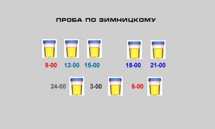 Анализ мочи по зимницкому для детей: сбор материала, норма и расшифровка результатов