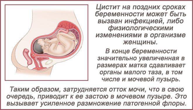 Жжение, резь и боль при мочеиспускании во время беременности