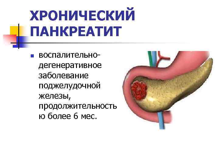 Лечение панкреатита, гастроскопия поджелудочной железы