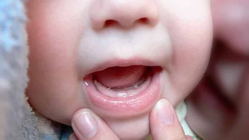 Одонтогенный синусит или гайморит от проблемных зубов | лор боклин а. к.