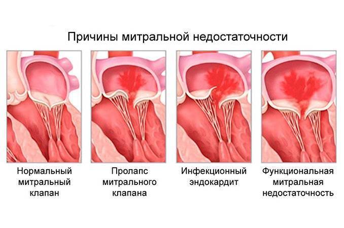 Ультразвуковая семиотика и диагностика в кардиологии детского возраста