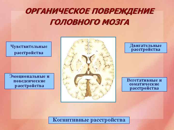 Кто такой невролог - что лечит, проверяет и смотрит невропатолог