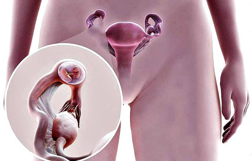 Овариальный резерв яичников — запас яйцеклеток ограничен