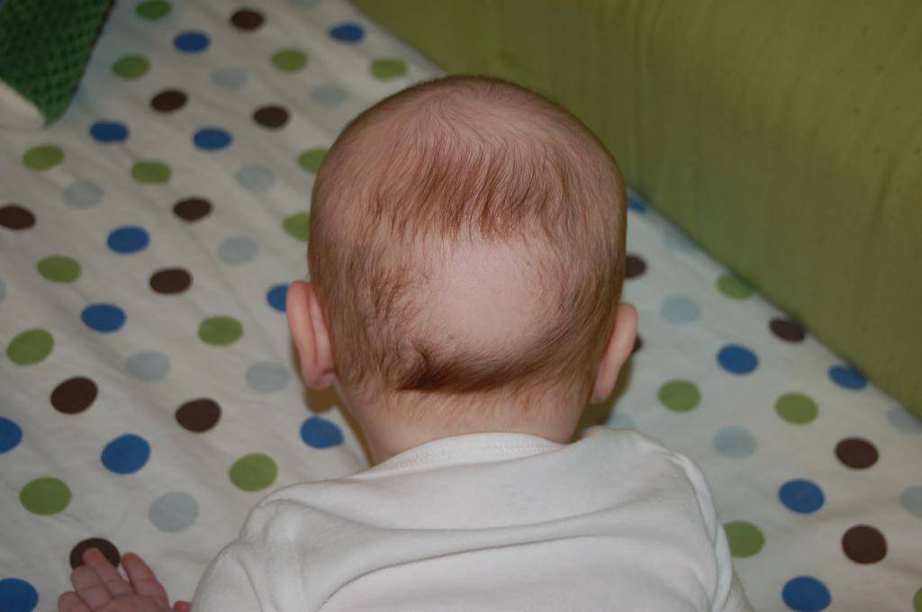 Волосяной покров младенцев: особенности состояния, причины выпадения и правила ухода