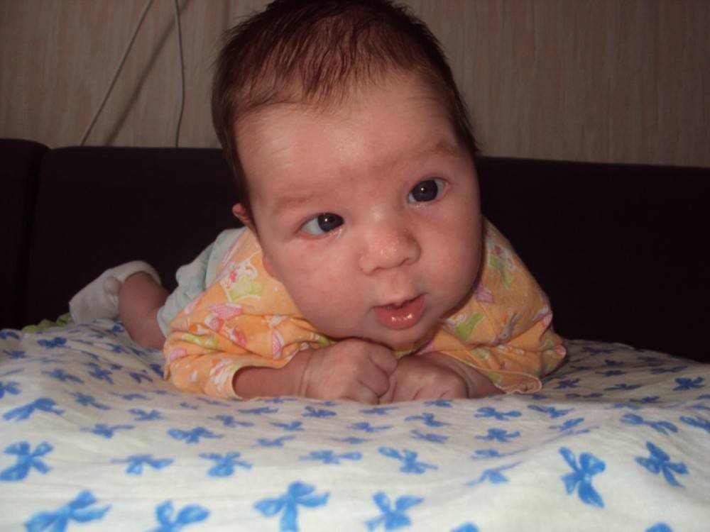 Косят глаза у новорожденного: нормально ли это, причины, советы доктора комаровского