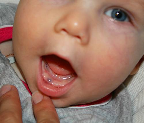 Во сколько прорезаются первые зубы у младенцев и какие, чем малышу помочь