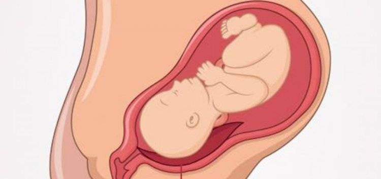 Повышенный тонус матки: чем опасен и как его снять? - наблюдение беременности.  здоровье