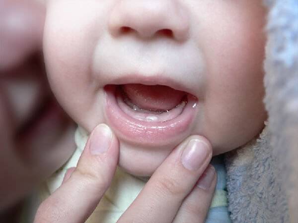 Режутся зубы: как помочь ребенку — симптомы, состояние здоровья, обезболивание