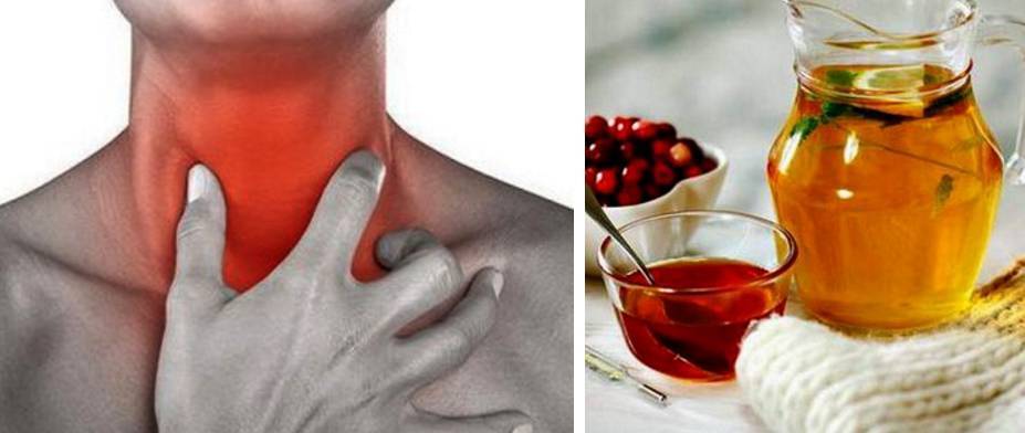 Боль в горле: причины и лечение