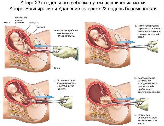 Шейка матки перед месячными и при беременности | pro-md.ru