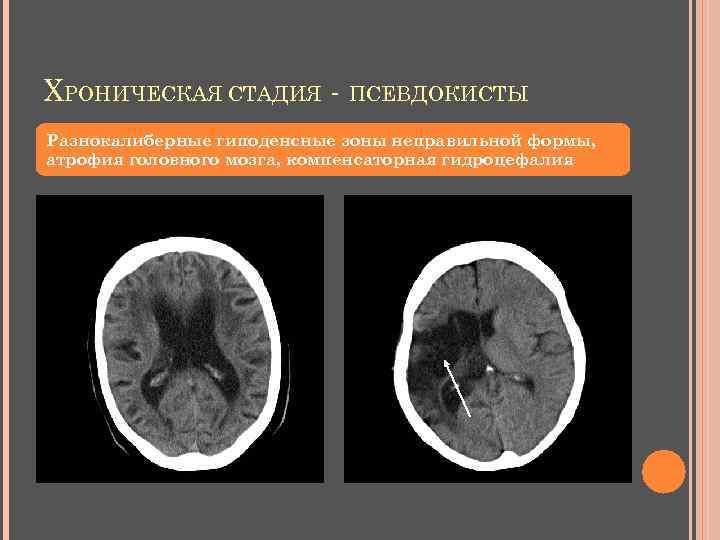Нарушение венозного оттока: что это такое, причины, симптомы и способы лечения - московский центр остеопатии