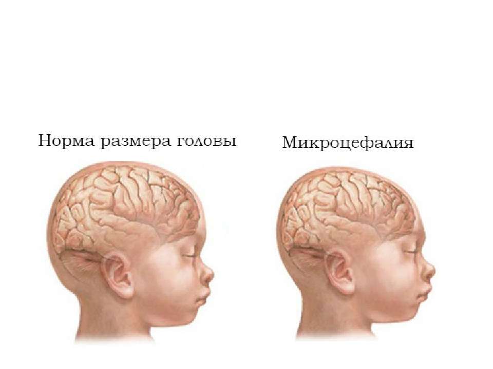 Незрелость коры головного мозга ребенка: последствия и лечение новорожденных