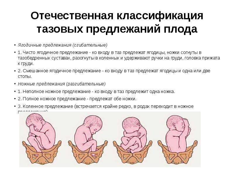 Предлежание плода – что нужно знать будущей маме - наблюдение беременности.  здоровье