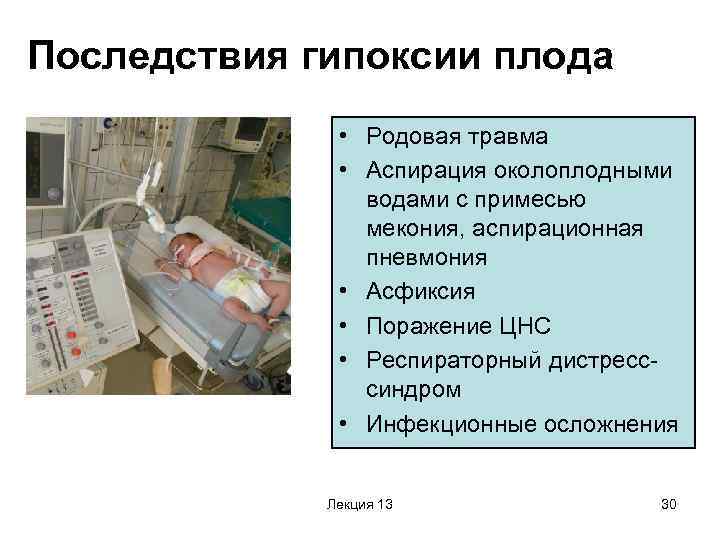 Гипоксия новорожденного: симптомы, реабилитация, последствия