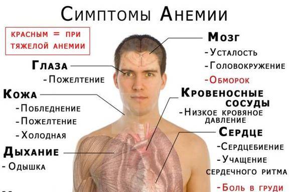 Анемия (малокровие): причины, симптомы, диагностика и лечение малокровия - сибирский медицинский портал