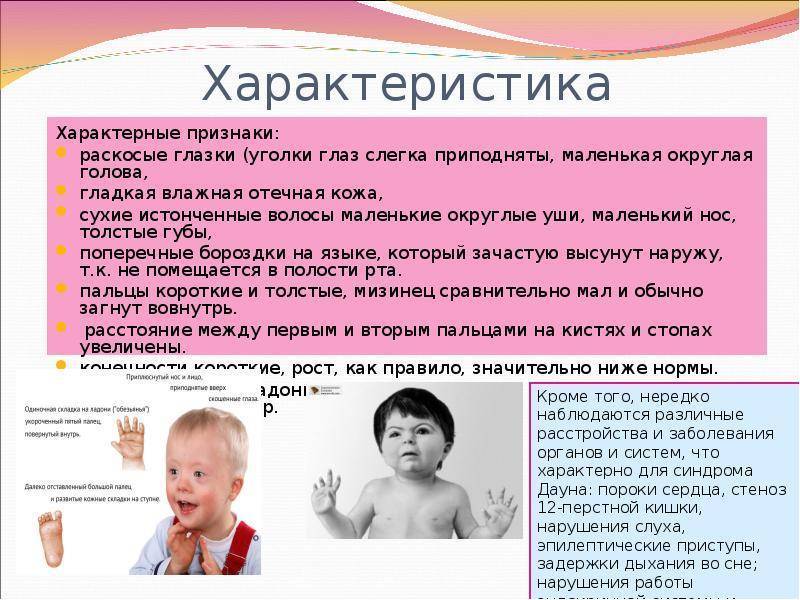 Дефицит внимания у детей: лечение, чем обусловлен синдром гиперактивности у ребенка, причины и симптомы сдвг