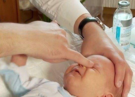 Мануальное лечение дакриоцистита, или как правильно делать массаж слезного канала у новорожденных