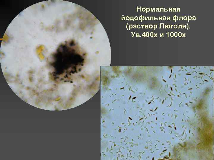 Йодофильная флора в кале у взрослого в копрограмме: признаки бактерий, исследование патогенной микрофлоры