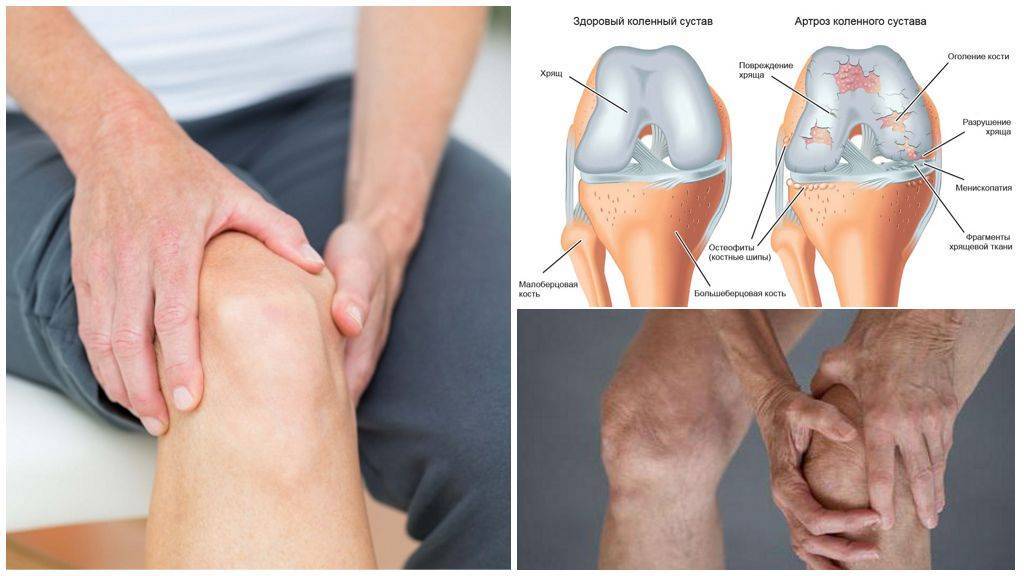 14 причин боли в коленях. как определить этиологию и правильно начать восстановление? :: polismed.com