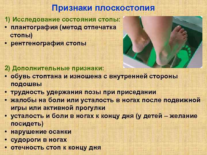 Плоскостопие у детей врач