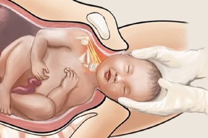 Врачи назвали самые частые патологии при рождении ребёнка
