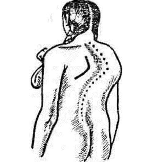 Лечебный массаж спины