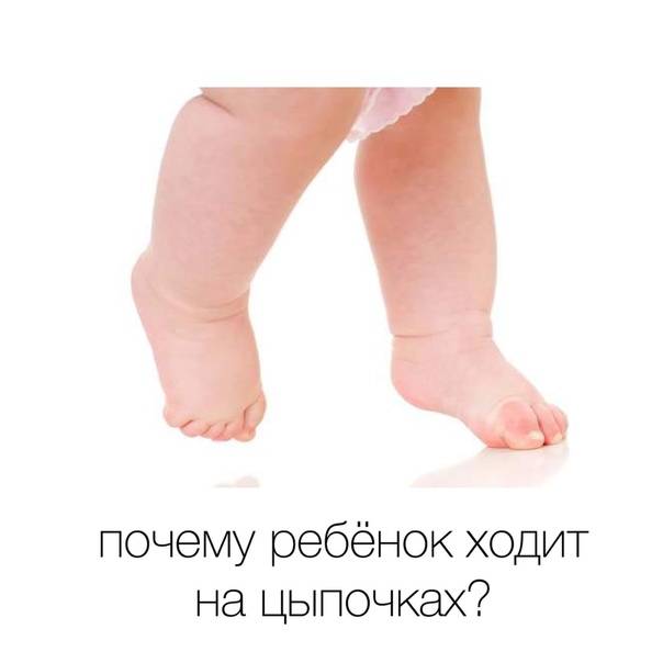 Хождение на носочках – что делать, если ребенок ходит на цыпочках